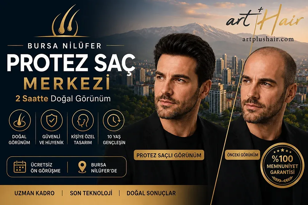 Bursa Nilüfer Protez Saç Merkezi