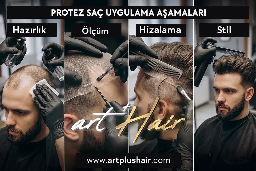 Protez Saç - %100 Doğal İnsan Saçı Gibi - Art Plus Hair Protez Saç Uygulama Süreci
