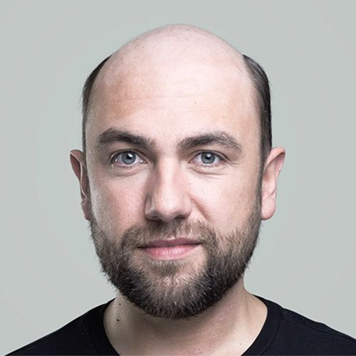 Ana Sayfa - Art Plus Hair Protez Saç Öncesi-1