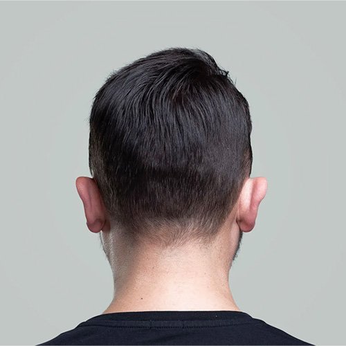 Ana Sayfa - Art Plus Hair Protez Saç Sonrası-4