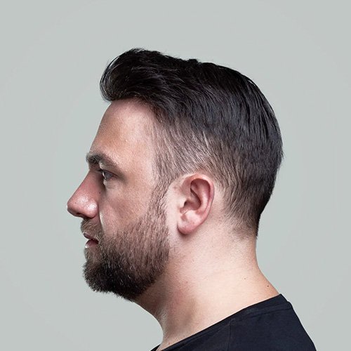 Ana Sayfa - Art Plus Hair Protez Saç Sonrası-3