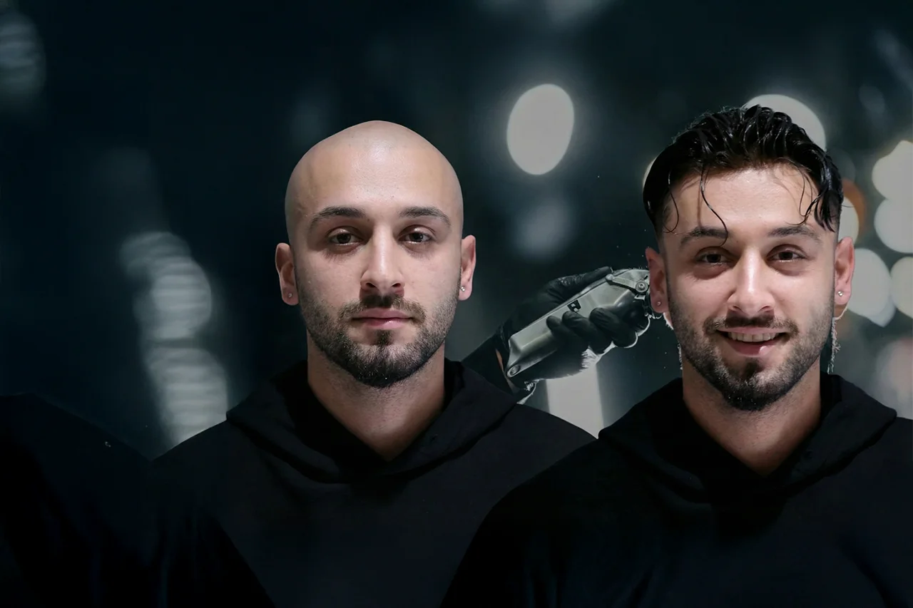 Protez saç yaptırdım