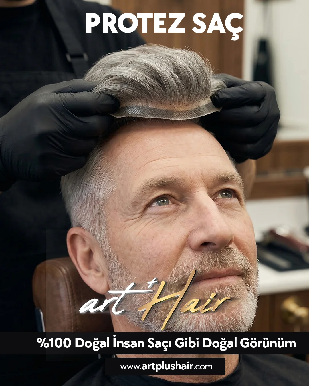 Protez Saç Antalya Tavsiye